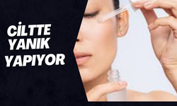 Dikkat! Retinol Doğru Kullanılmazsa Ciltte Yanık Yapıyor