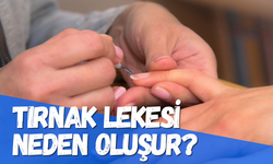 Tırnakta beyaz leke | Tırnakta beyaz leke nasıl geçer?