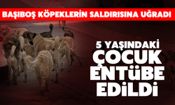 5 yaşındaki çocuğa başıboş köpekler saldırdı: Durumu ağır!