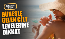 Güneşle gelen lekelere dikkat