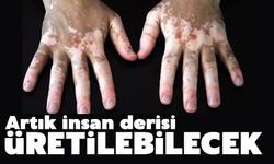 Artık insan derisi üretilebilecek