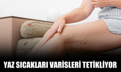 Yaz Sıcakları Varisleri Tetikliyor