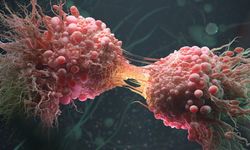 Jinekolojik kanserlerde erken farkındalık uyarısı: “Tek belirtiyle tanı konulamaz”