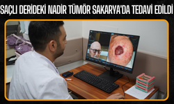 Saçlı derideki nadir tümör Sakarya'da tedavi edildi