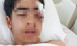 15 yaşındaki çocuk muştayla öldüresiye dövüldü