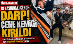 Sakarya’da 18 yaşındaki gence darp! Çene kemiği kırıldı