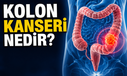 Kolon Kanseri Nedir? Belirtileri Nelerdir? Hangi Yaşlarda Daha Sık Görülüyor?