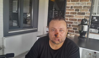 Pitbull Saldırısına Uğrayan Onur Akay Ameliyata Alınıyor