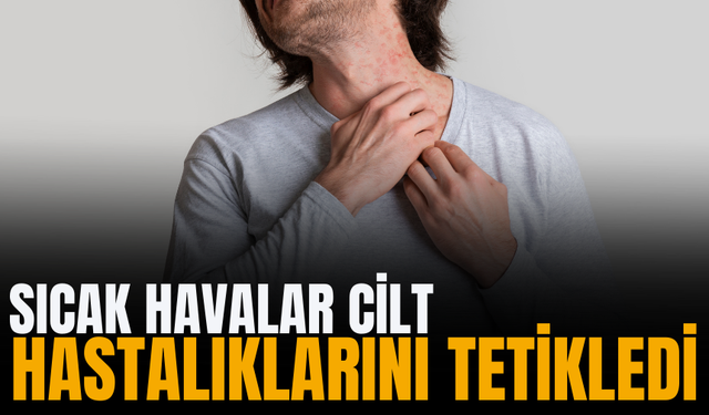 Sıcak havalar cilt hastalıklarını tetikledi