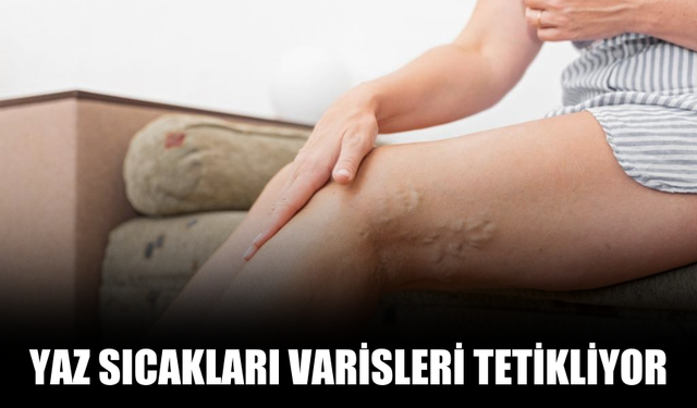 Yaz Sıcakları Varisleri Tetikliyor
