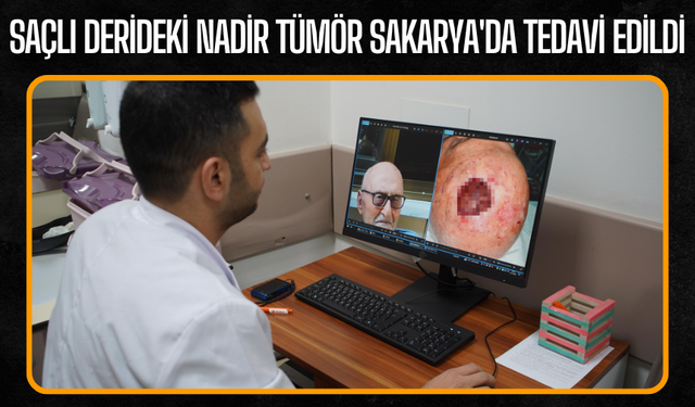 Saçlı derideki nadir tümör Sakarya'da tedavi edildi