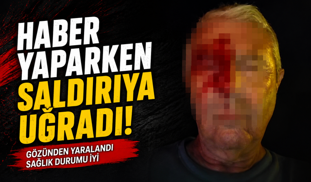 Haber yaparken saldırıya uğradı!