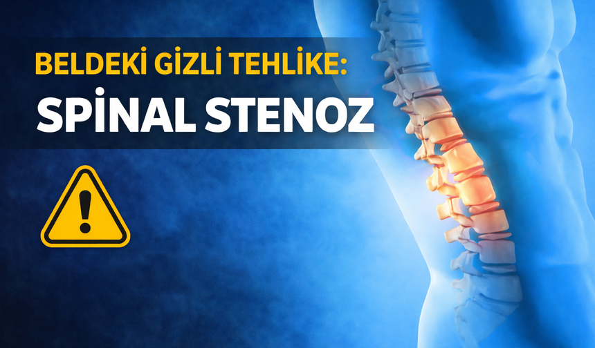 Omurga Daralmasına Dikkat: