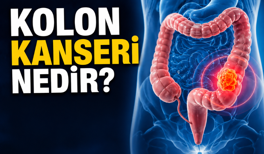 Kolon Kanseri Nedir? Belirtileri Nelerdir? Hangi Yaşlarda Daha Sık Görülüyor?