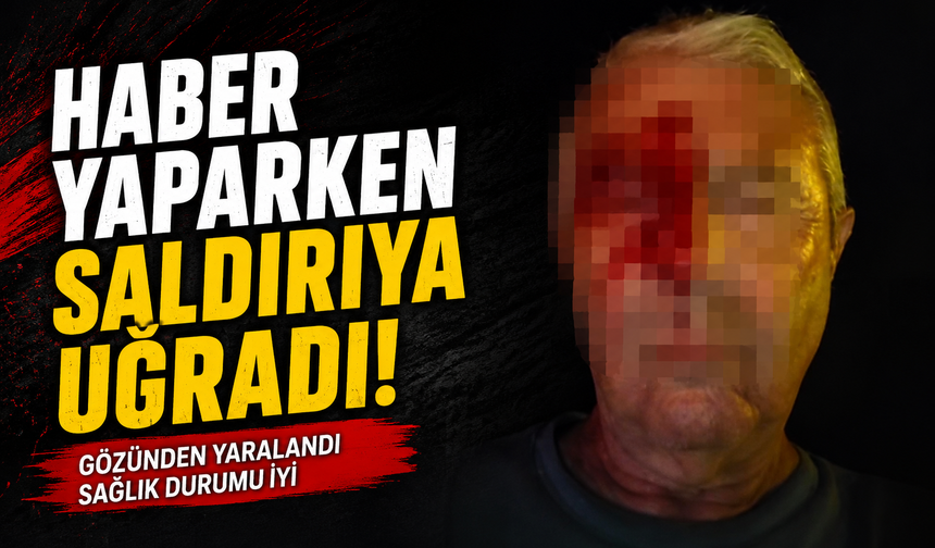 Haber yaparken saldırıya uğradı!