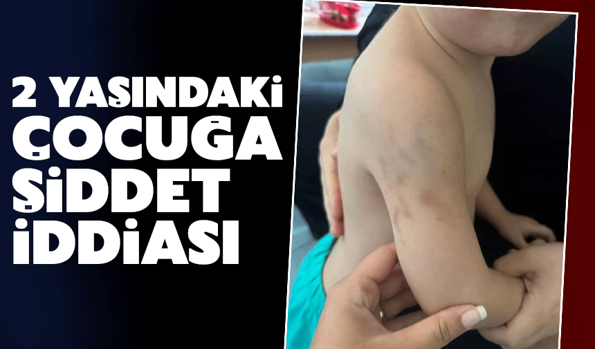 2 yaşındaki çocuğa şiddet iddiası!